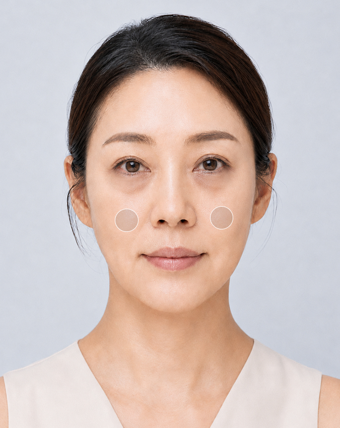 Eye Correction concern image