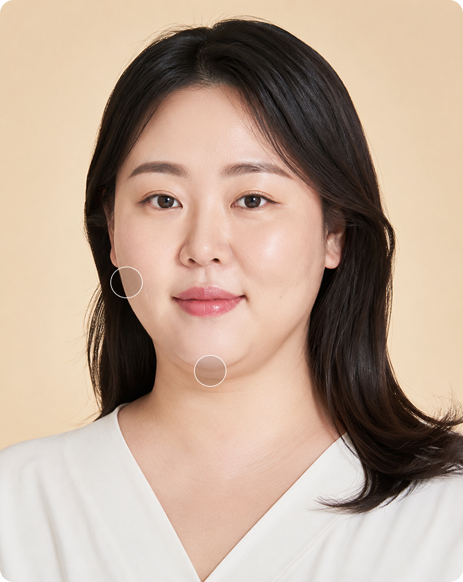 지방 감소 고민 이미지