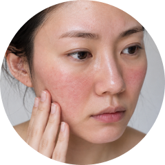 Dull Skin key point 3